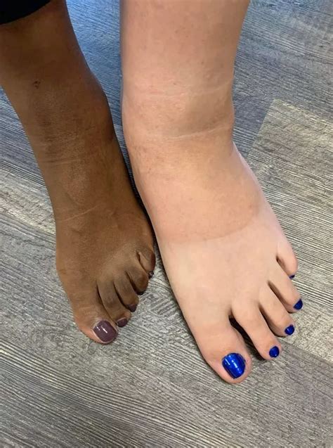 Woman Bags Guinness World Record For Worlds Largest Feet