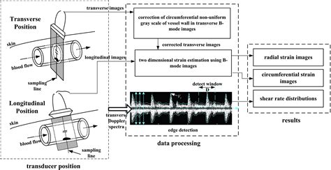 Non Invasive Vascular Radialcircumferential Strain Imaging And Wall