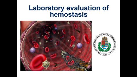 Laboratory Evaulation Of Hemostasis Youtube