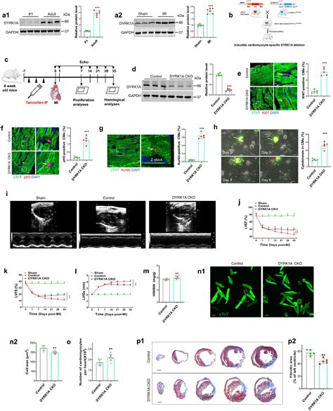 Inhibition Of Dyrk1a Via Histone Modification Promotes Cardiomyocyte