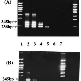 Sensitivity Of The Nested PCR A Electrophoretic Analysis Of PCR