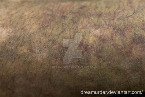 Zombie Skin by Dreamurder on DeviantArt