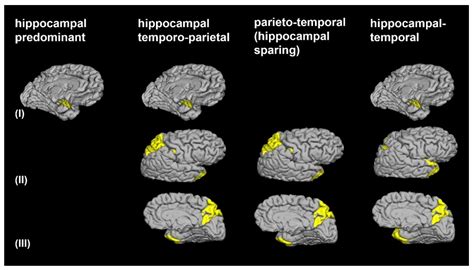 Brain Sciences Free Full Text Anatomically Standardized Detection