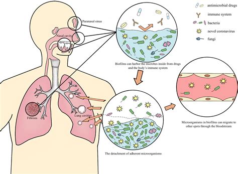 Frontiers Biofilms Possibly Harbor Occult SARS CoV 2 May Explain Lung