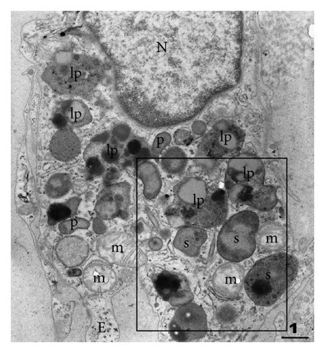 Transmission Electron Microscopy Tem Of Testicular Macrophages In The