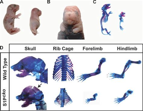 Severe Chondrodysplasia In S1pcko Mice A Newborn S1pcko Mice Right Download Scientific