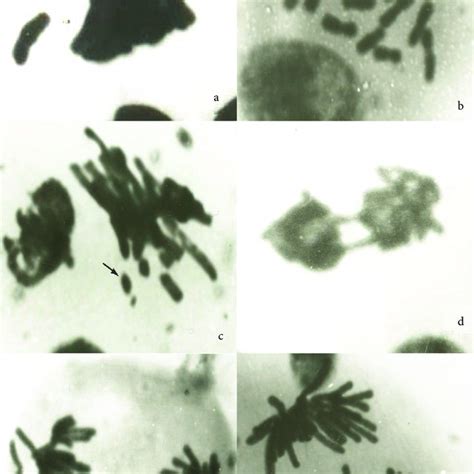 Different Types Of Aberrations Induced By Illoxan In Allium Cepa Root