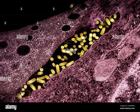 Transmission electron micrograph showing vesicular stomatitis virus VSV ...