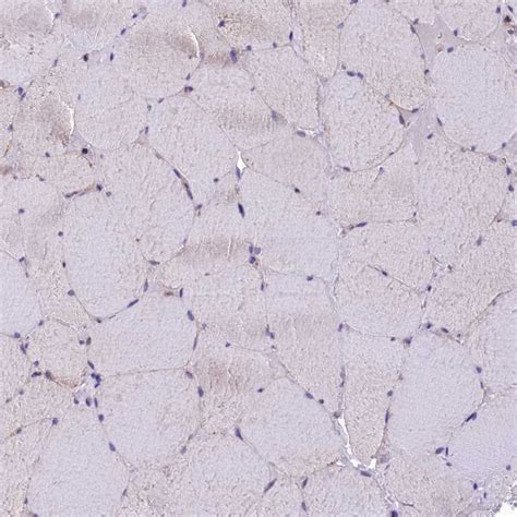 rabbit polyclonal anti dnajb antibody buy  research highly