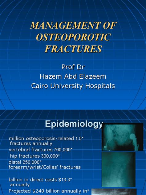 Pdf 1 21 Management Of Osteoporotic Fractures Dokumentips