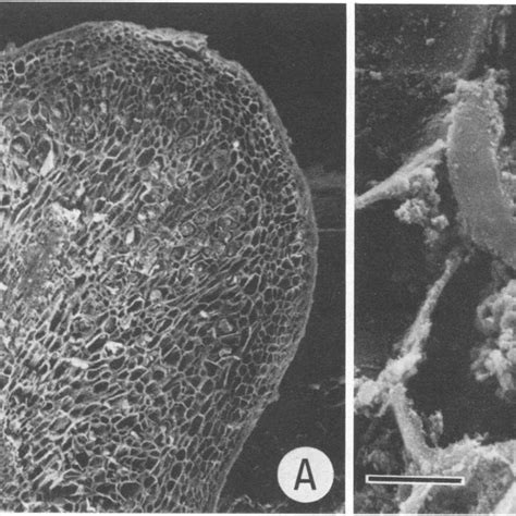 A Scanning Electron Micrograph Of An Aerial Nodule Section Showing