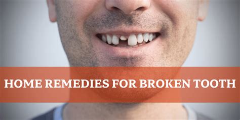 Home Remedies For Broken Tooth: Top Quick Relief Tips - Along The Rockies