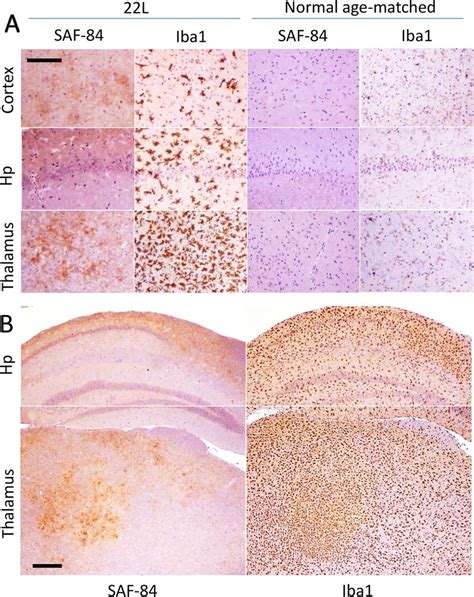 Immunohistochemistry Of 22l Infected Mouse Brains A Large