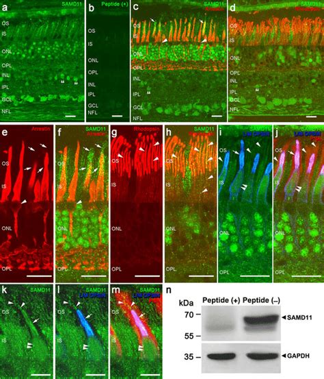 Immunolocalization Of SAMD11 In Vertical Sections Of Human Retina A