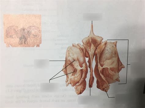 Anterior View Of Ethmoid Bone Diagram Quizlet