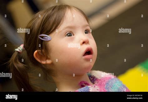 Toddler Girl With Downs Syndrome Stock Photo Alamy