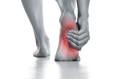 5 Methods To Manage Plantar Fasciitis Physio Network