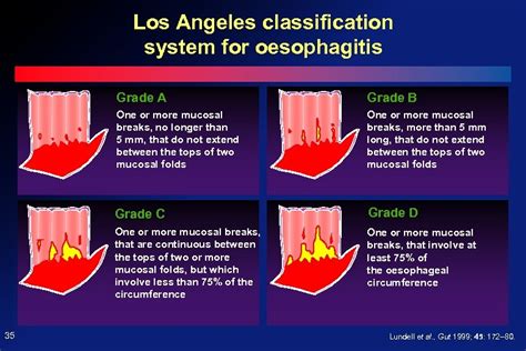 Esofagitis Clasificacion De Los Angeles