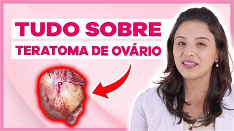 Teratoma de Ovário Tudo o que você precisa saber Vídeo cirurgia