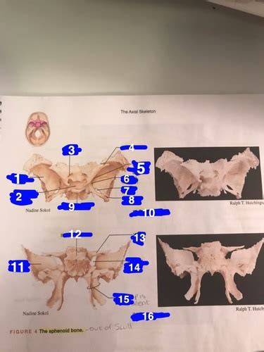 The Sphenoid Bone Lab Book Picture Flashcards Quizlet