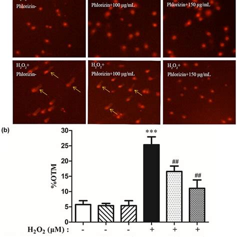 Effect Of Phlorizin On Apoptosis And Necrosis In Hepg Cells Were