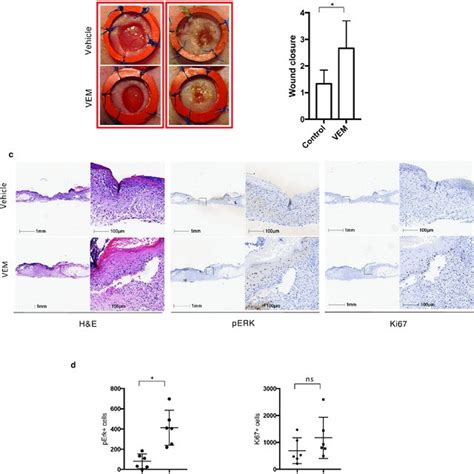 Topical Braf Inhibition Accelerates Wound Healing In An Excisional