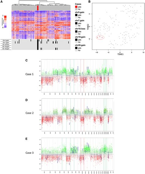 Unsupervised Hierarchical Clustering A And T‐stochastic Neighbor