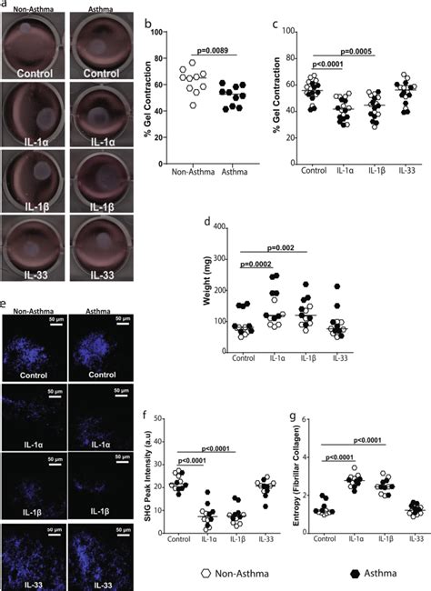 Epithelial Interleukin 1 Inhibits Collagen Formation By Airway