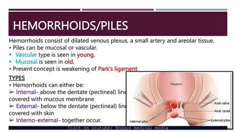 HEMORRHOIDS- anatomy, pathophysiology, clinical features, diagnosis and ...