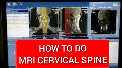 Cervical Spine Mri Scan Protocol Positioning And Planning On Ge 1 5