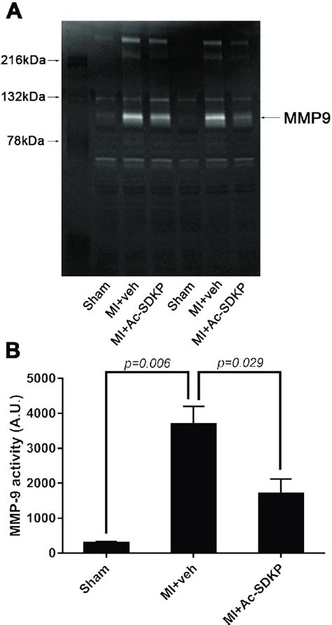 Effects Of Ac Sdkp On Cardiac Matrix Metalloproteinase Mmp Activity