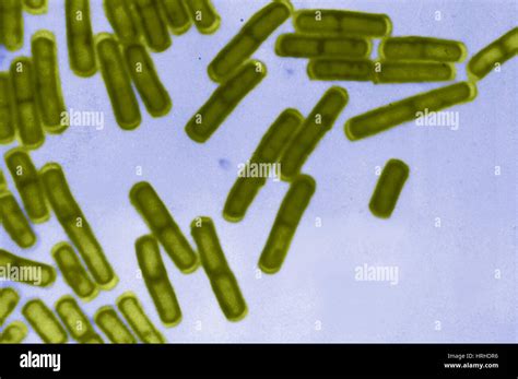 B Cereus Microscopy Hi Res Stock Photography And Images Alamy