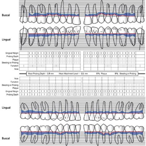 Psr Periodontal Chart