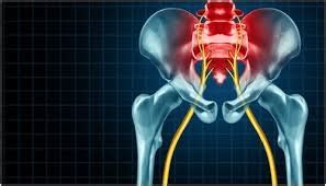 pain     sciatica michael rock md chicago