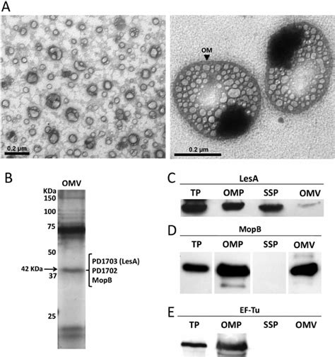 X Fastidiosa Outer Membrane Vesicle Omv Visualization And Protein