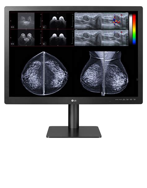 LG MED 31IN 12MP DIAG DISP ALL MODALITIES+BREAST CALIBRATE SOFT (31HN713D-B)