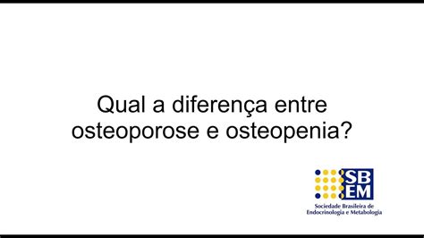 Qual A Diferen A Entre Osteoporose E Osteopenia Youtube