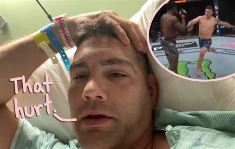 Ufc Fighter Suffers Gruesome Snapped Leg After Shin Kick Goes Terribly