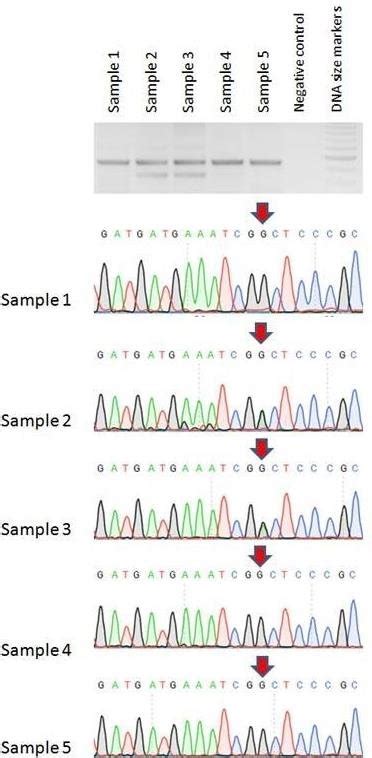 Dna Sequence Chromatograms Of Representative Samples A Different Pair