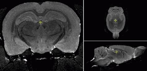 High Res T2 Weighted Mri Of The Rat Brain Ex Vivo Brain