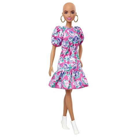 Barbie: Pela primeira vez, Barbie lança bonecas careca e com vitiligo