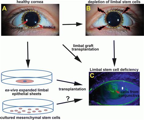 Corneal Stem Cells A Source Of Cell Renewal With Therapeutic Potential