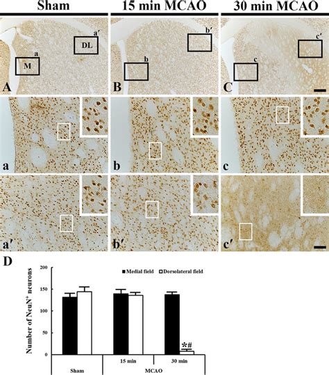 Representative Images Of Neun Immunohistochemistry In The Cp Of The