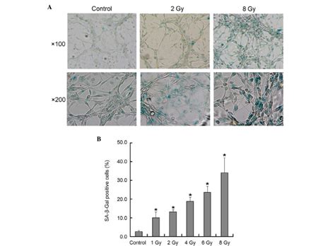 Bmi Induces Radioresistance By Suppressing Senescence In Human U