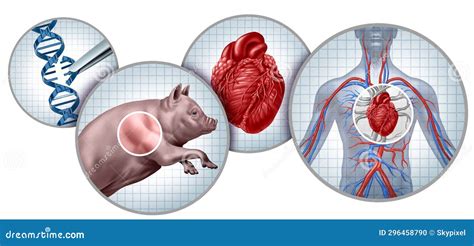 Pig To Human Heart Transplant Stock Photography Cartoondealer