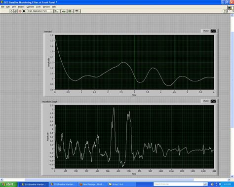 How do you remove baseline wandering from an ECG? - NI Community