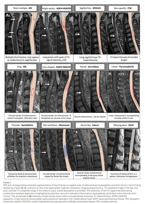 MedClub On Twitter RT CarlosJMoreno Neurology Review