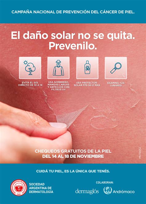 “el Daño Solar No Se Quita” Cómo Es La Campaña Anual De Prevención Del