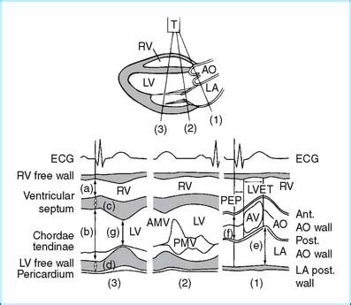 Lv Measurements Echo Literacy Basics