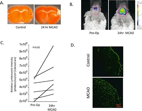 Non Invasive Imaging Of Smad Response Following Middle Cerebral